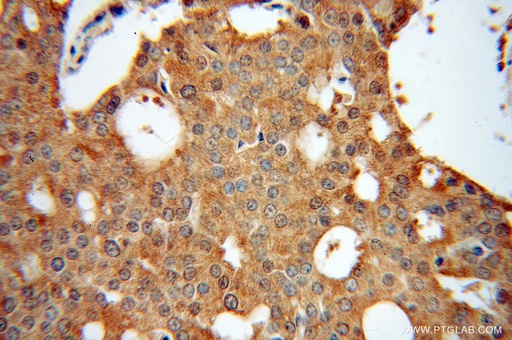 [13529-1-AP-150UL] EML2 Polyclonal antibody