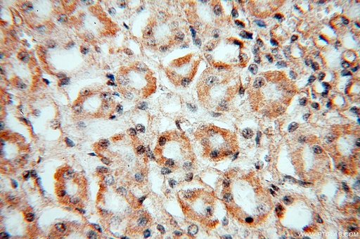[13530-1-AP-20UL] Nidogen 2 Polyclonal antibody