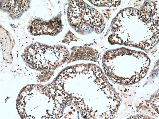[13531-1-AP-20UL] Proenkephalin-A Polyclonal antibody