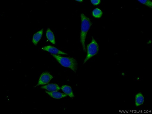 [13536-1-AP-150UL] FSCN3 Polyclonal antibody