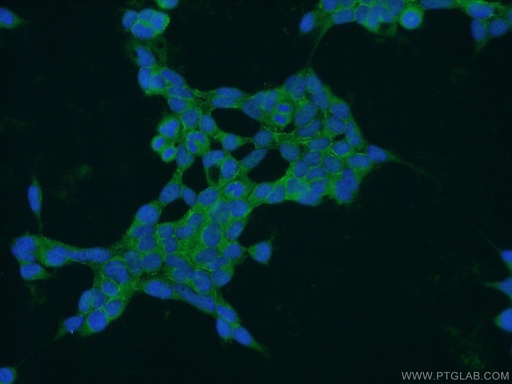[13539-1-AP-150UL] PAK6 Polyclonal antibody