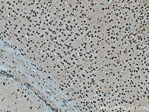 [13540-1-AP-150UL] TBL1X Polyclonal antibody