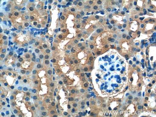 [13541-1-AP-150UL] FUK Polyclonal antibody