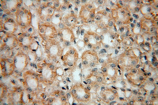 [13544-1-AP-20UL] PDSS2 Polyclonal antibody