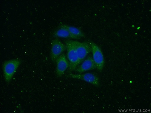 [13545-1-AP-150UL] Alpha-2-Macroglobulin Polyclonal antibody