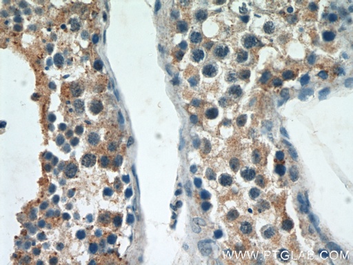 [13546-1-AP-150UL] ST3GAL4 Polyclonal antibody