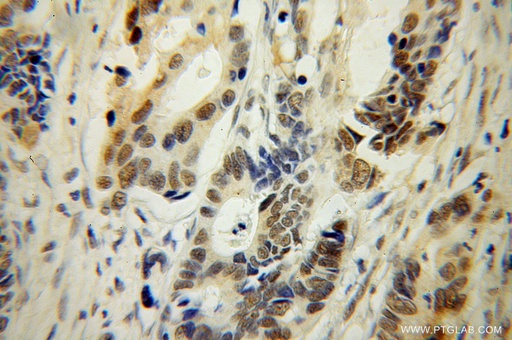 [13547-1-AP-20UL] TFEC Polyclonal antibody