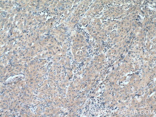 [13552-1-AP-20UL] COG7 Polyclonal antibody