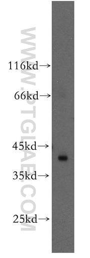[13555-1-AP-150UL] RAD51L1 Polyclonal antibody