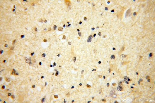 [13557-1-AP-150UL] BRUNOL5 Polyclonal antibody