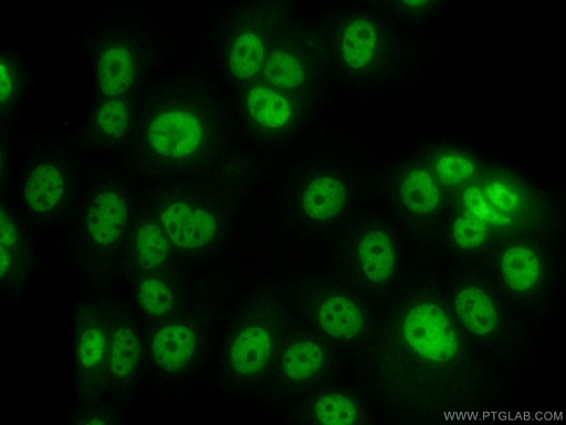 [13559-1-AP-20UL] APC2 Polyclonal antibody