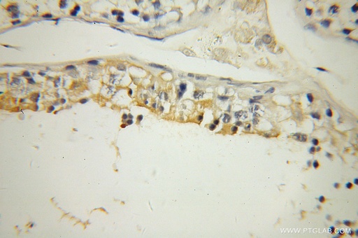 [13568-1-AP-150UL] UBQLN3 Polyclonal antibody