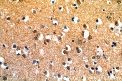 [13572-1-AP-150UL] SIRT6 Polyclonal antibody