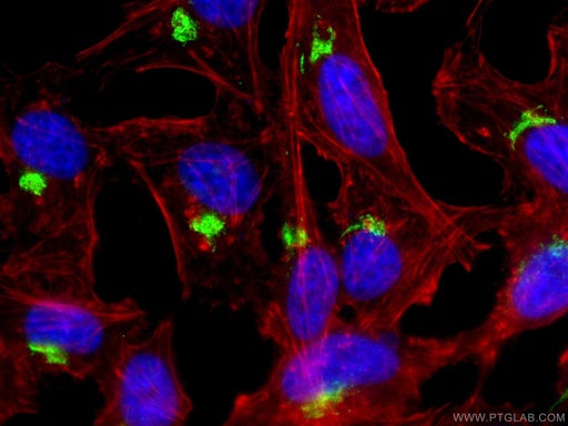 [13573-1-AP-150UL] TGN46 Polyclonal antibody