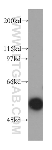 [13576-1-AP-150UL] MNDA Polyclonal antibody
