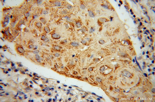[13578-1-AP-150UL] ABCG1 Polyclonal antibody