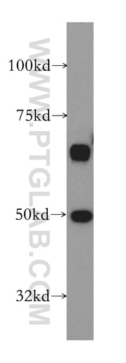 [13579-1-AP-150UL] STK24 Polyclonal antibody