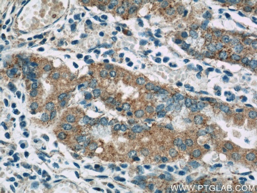 [13581-1-AP-20UL] FAU Polyclonal antibody