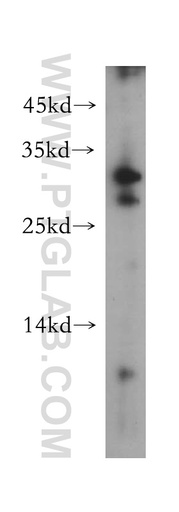 [13590-1-AP-150UL] CLEC10A/CD301 Polyclonal antibody