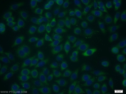 [13593-1-AP-150UL] RIOK3 Polyclonal antibody