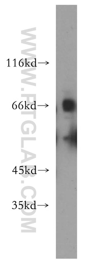 [13594-1-AP-150UL] SLC22A2 Polyclonal antibody