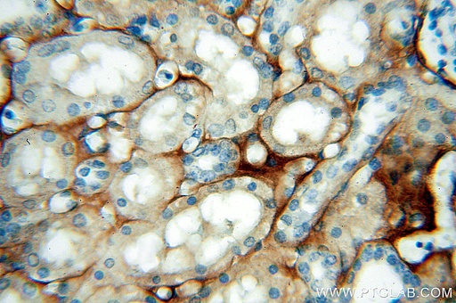 [13595-1-AP-150UL] Tenascin-X Polyclonal antibody