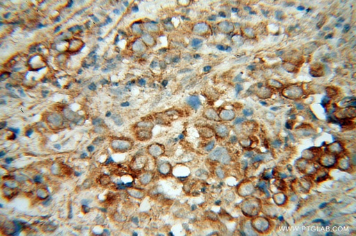 [13598-1-AP-20UL] Cadherin-7 Polyclonal antibody