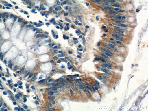 [13601-1-AP-150UL] ITM2C Polyclonal antibody