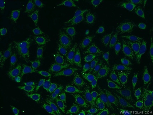 [13604-1-AP-20UL] Carboxypeptidase A6 Polyclonal antibody