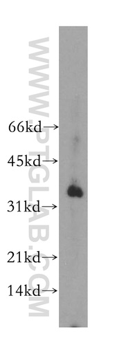 [13605-1-AP-150UL] POU2AF1 Polyclonal antibody