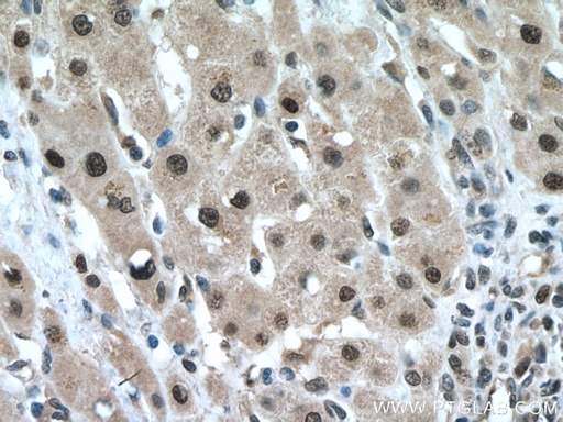 [13606-1-AP-20UL] FBXO22 Polyclonal antibody