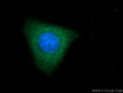 [13607-1-AP-20UL] TOB2 Polyclonal antibody