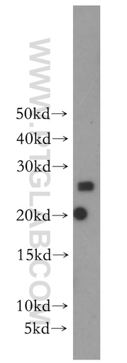 [13612-1-AP-20UL] SCN2B Polyclonal antibody