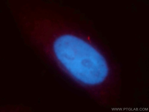 [13614-1-AP-150UL] MLXIP Polyclonal antibody