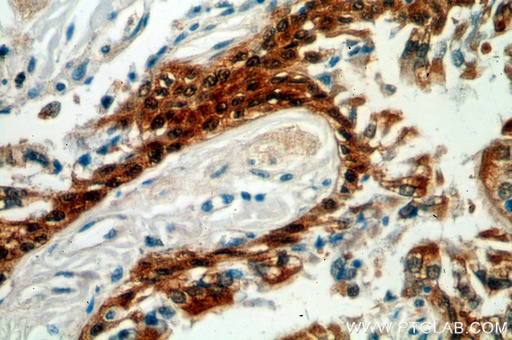 [13616-1-AP-150UL] HSPA6 Polyclonal antibody