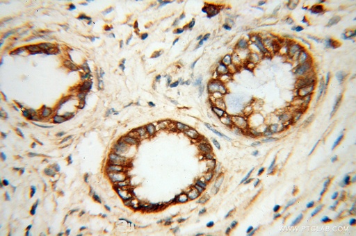 [13619-1-AP-150UL] SERCA3 Polyclonal antibody