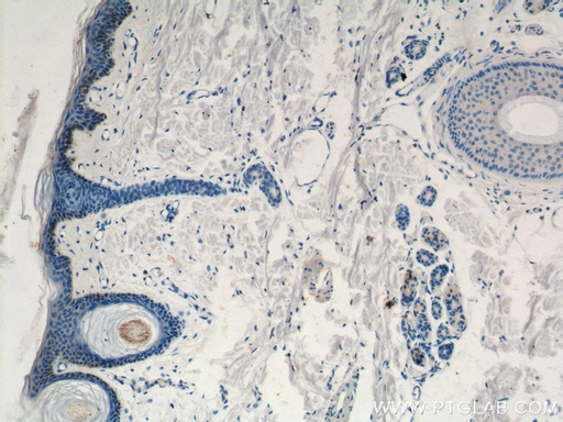 [13620-1-AP-20UL] ST3GAL2 Polyclonal antibody