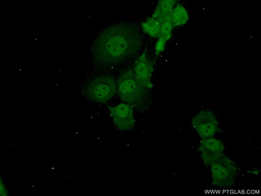 [13621-1-AP-20UL] ADAT2 Polyclonal antibody