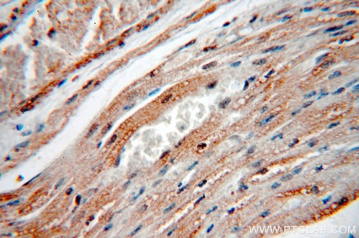 [13622-1-AP-150UL] KCNH7 Polyclonal antibody