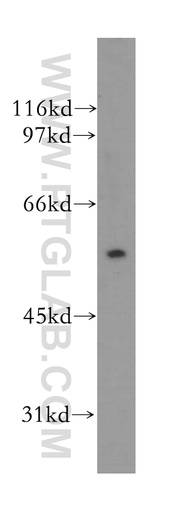 [13623-1-AP-150UL] TRIM15 Polyclonal antibody