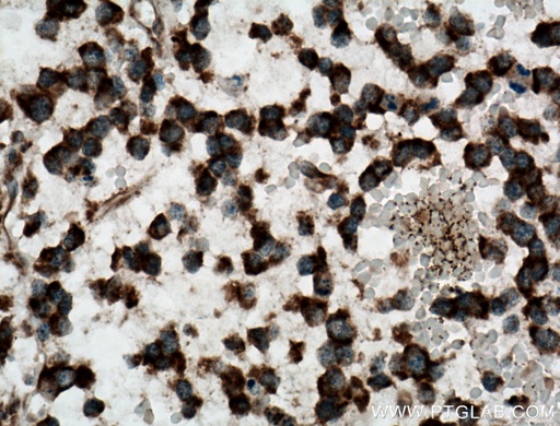 [13624-1-AP-20UL] CAMKK1 Polyclonal antibody