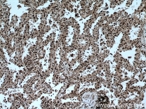 [13625-1-AP-150UL] GMFG Polyclonal antibody