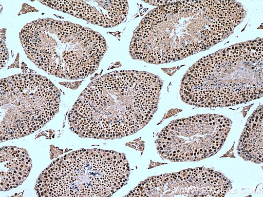 [13627-1-AP-20UL] NSMCE2 Polyclonal antibody