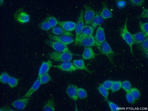 [13630-1-AP-150UL] CREB3L4 Polyclonal antibody