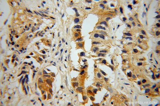 [13631-1-AP-20UL] PNMA1 Polyclonal antibody