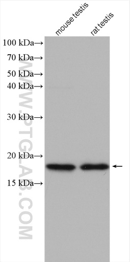 [13633-1-AP-20UL] TPPP2 Polyclonal antibody