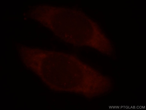 [13634-1-AP-20UL] TROAP Polyclonal antibody