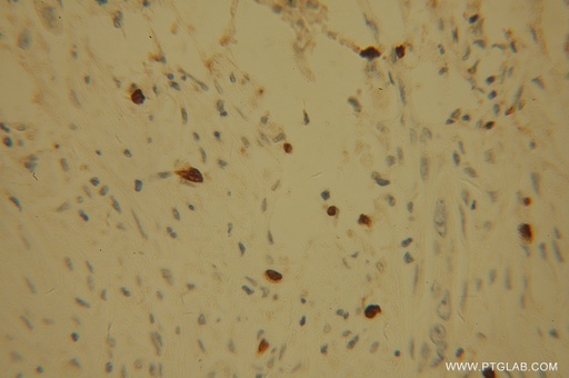 [13635-1-AP-150UL] POLI Polyclonal antibody