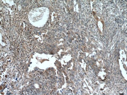 [13637-1-AP-150UL] TULP3 Polyclonal antibody