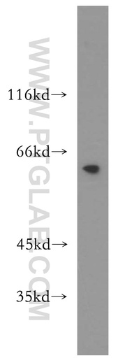 [13638-1-AP-20UL] MAK Polyclonal antibody
